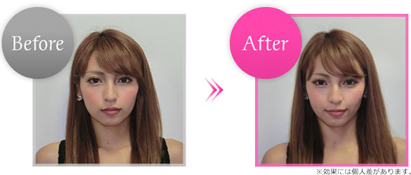 Before&After画像