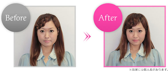 Before��After�摜