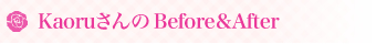 Miki�����Before��After