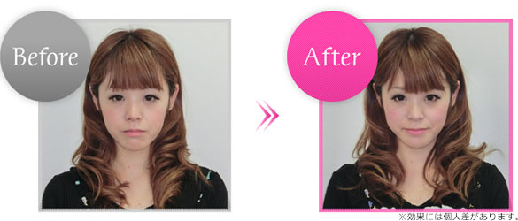 Before��After�摜