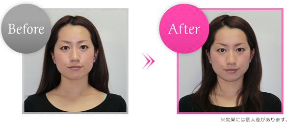 Before��After�摜