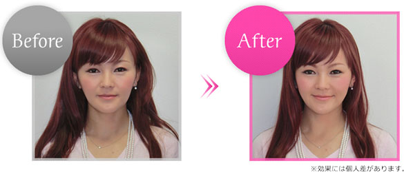 Before��After�摜