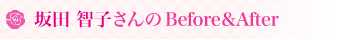 ��c �q�q�����Before��After