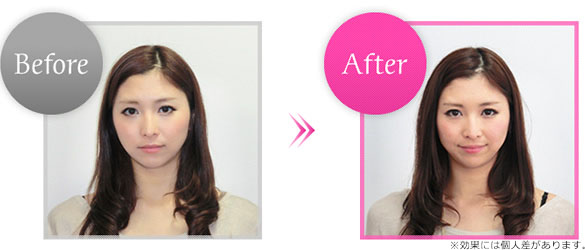 Before��After�摜