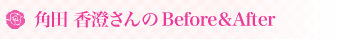 �p�c ���������Before��After
