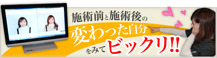 施術前と施術後の変わった自分をみてビックリ!!