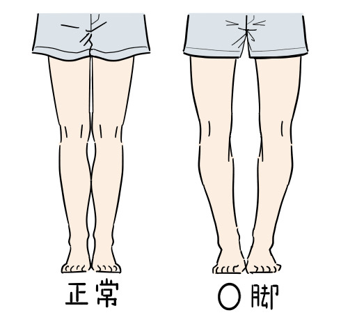 o脚 治し方 